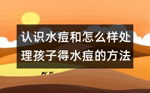 認識水痘和怎么樣處理孩子得水痘的方法