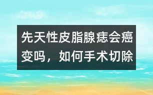 先天性皮脂腺痣會癌變嗎，如何手術切除