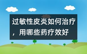 過敏性皮炎如何治療，用哪些藥療效好