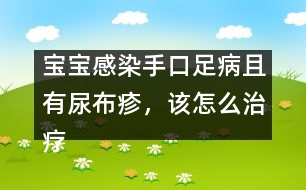 寶寶感染手口足病且有尿布疹，該怎么治療