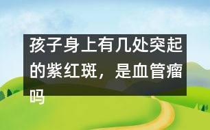 孩子身上有幾處突起的紫紅斑，是血管瘤嗎